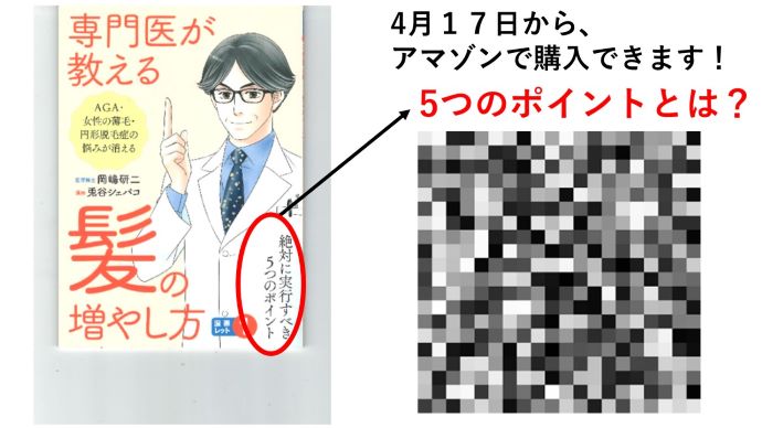 円形脱毛症　病院